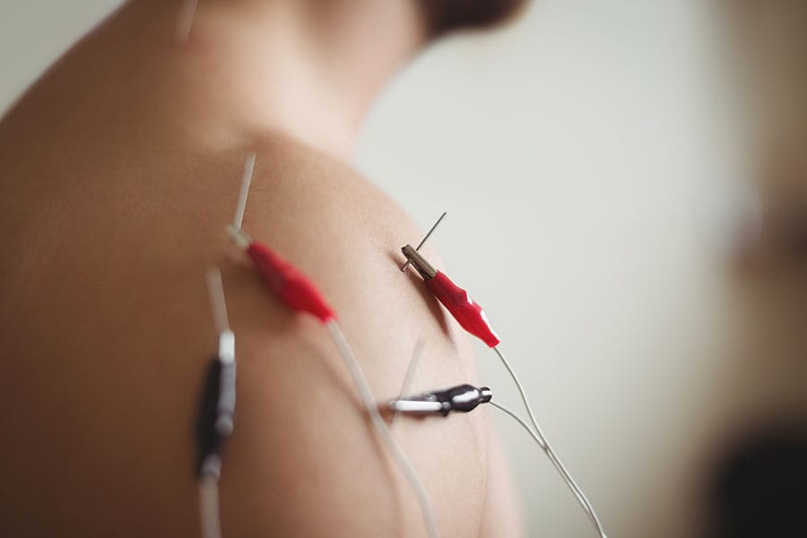 Electrodes attached to a shoulder