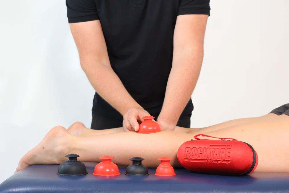 Cupping therapy on a person's leg.