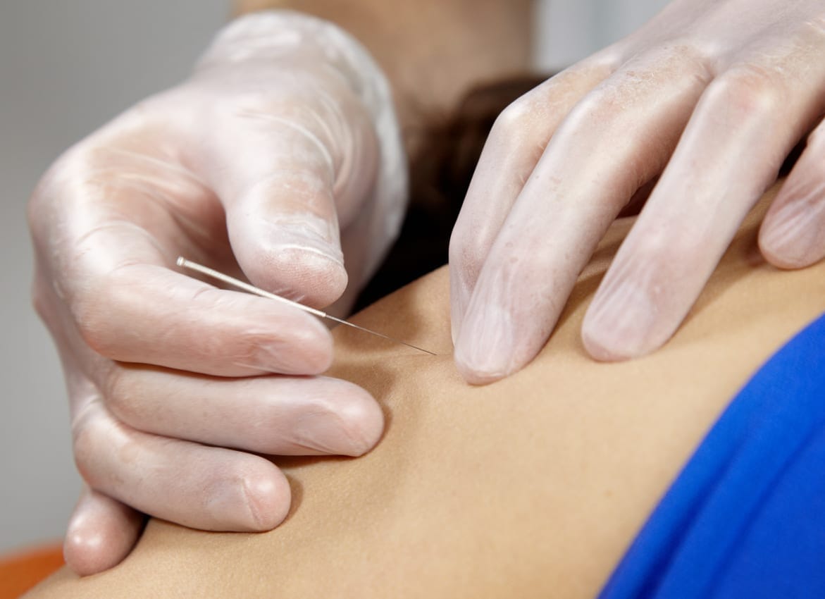 Needle insertion on a person's back
